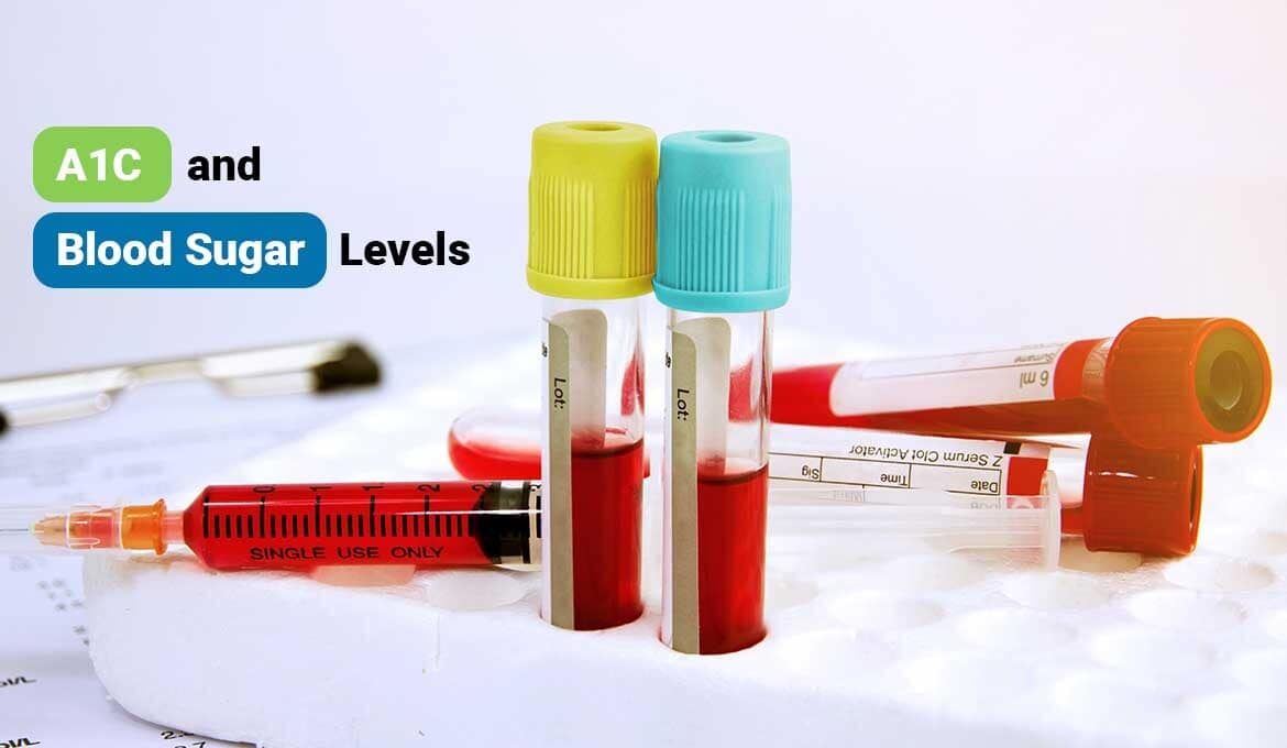 A1C and Blood Sugar Levels