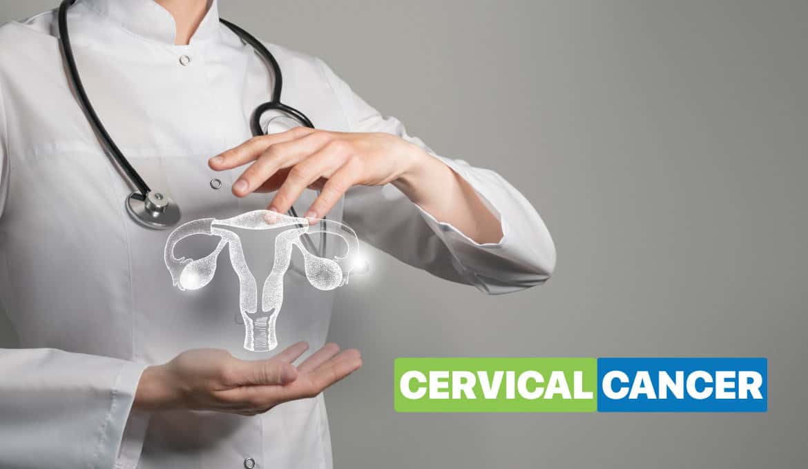 Cervical Cancer