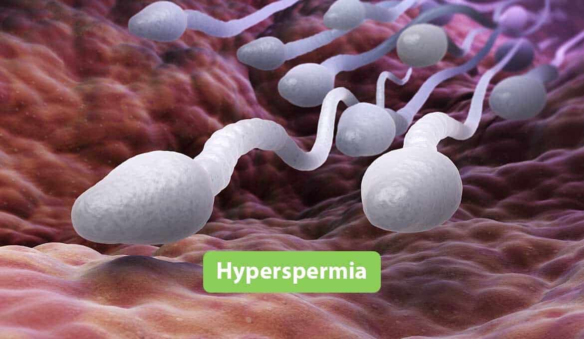 Hyperspermia