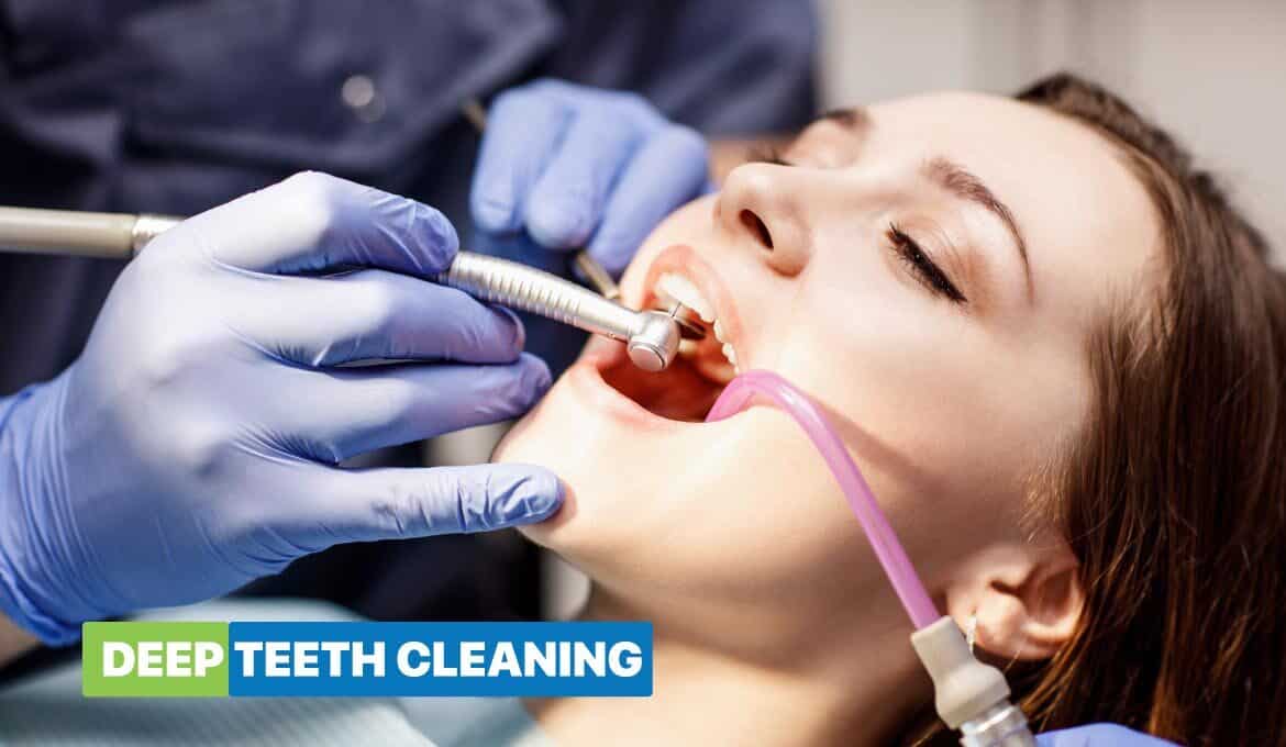 Deep Teeth Cleaning