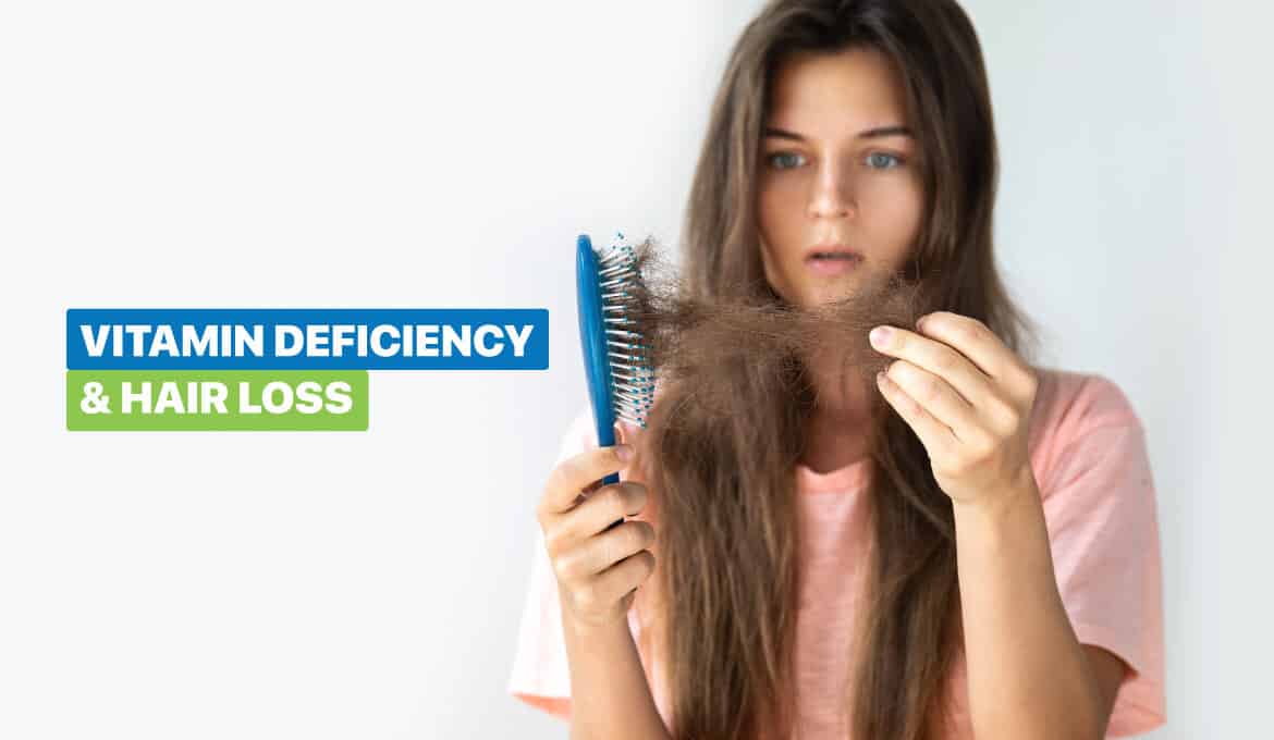 Which Vitamin Deficiency Causes Hair Loss